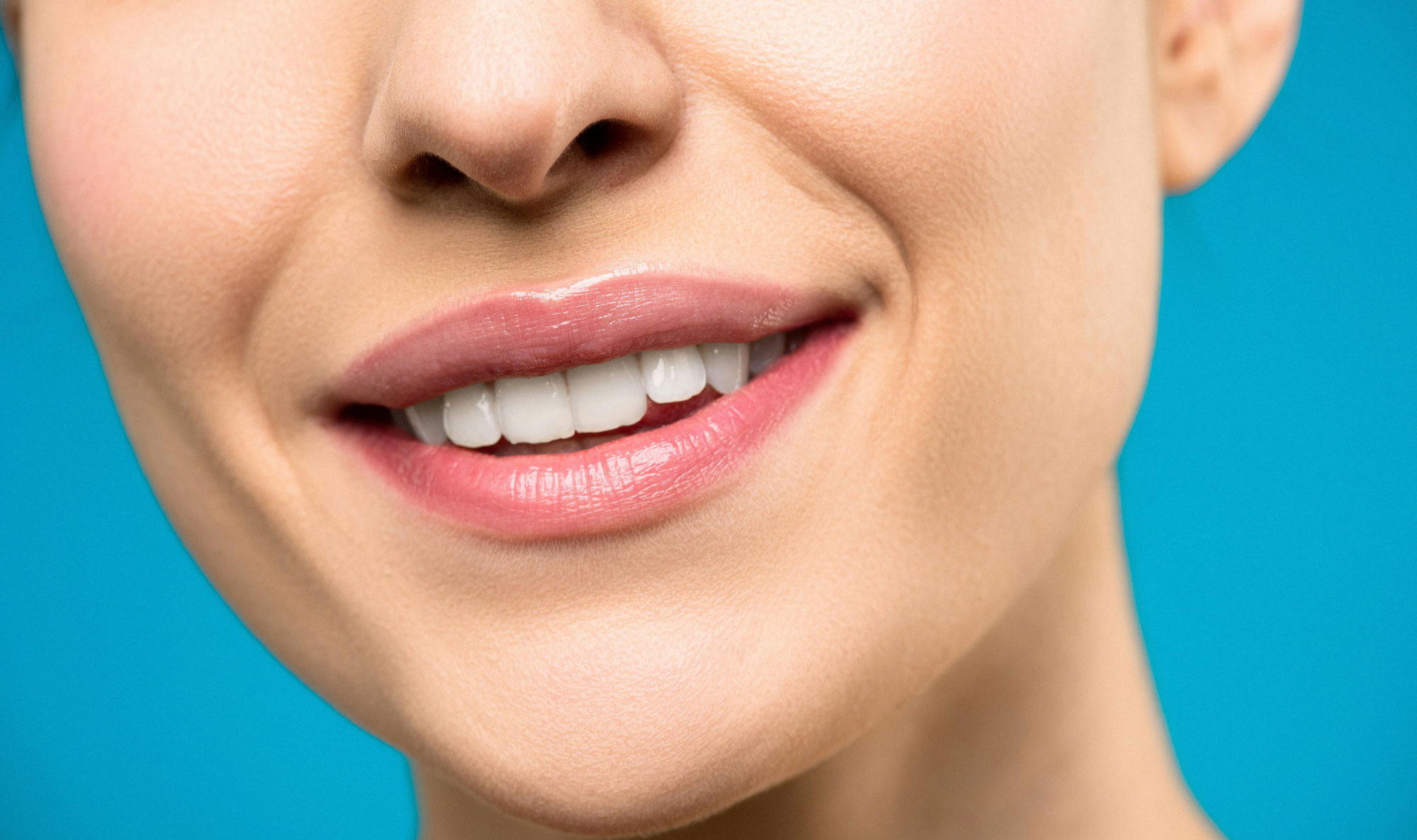 Dental Bridges