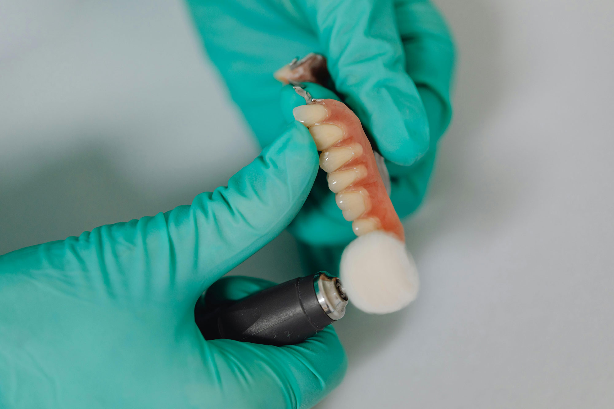 Implant Crowns Implant Crowns