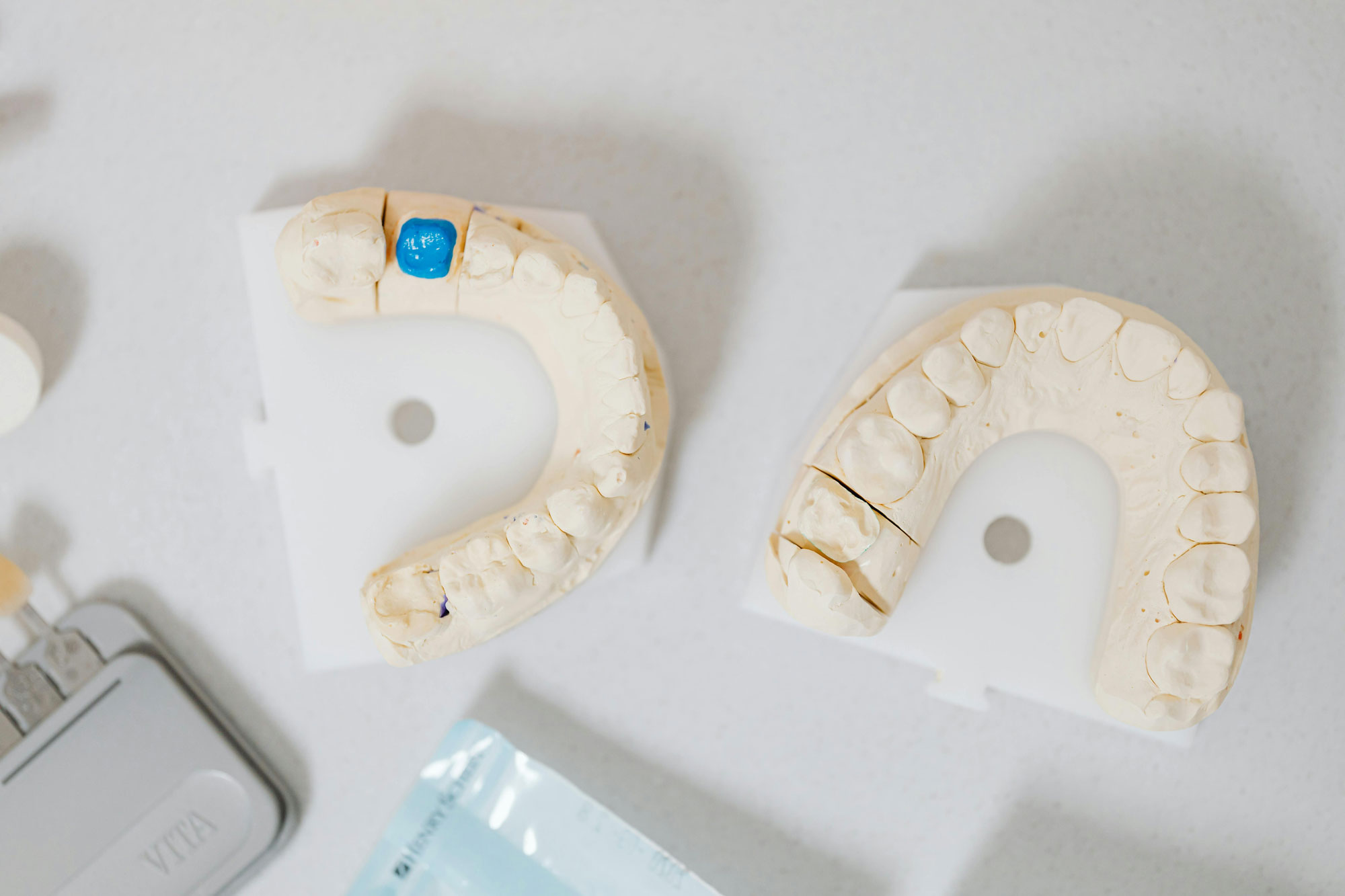 Implant Crowns Implant Crowns